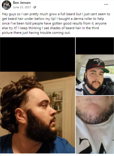 beard roller facebook reviews